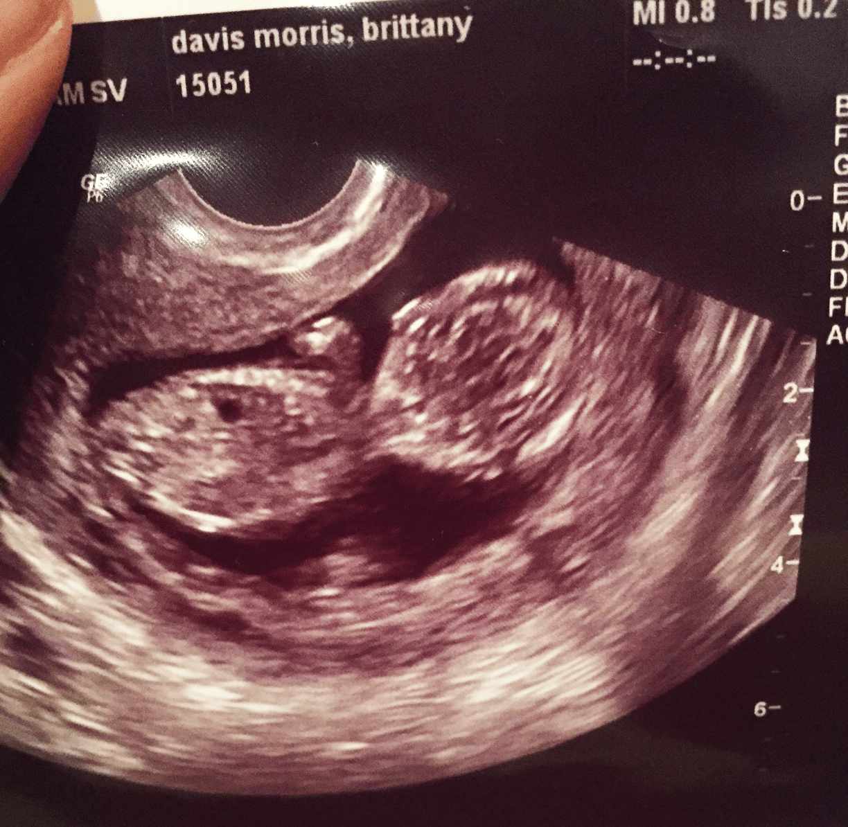 Baby Sonogram